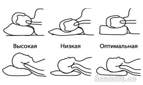 подбор ортопедической подушки
